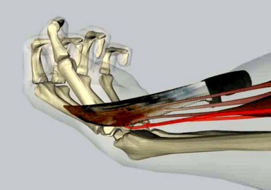 Image from a Forensic Pathology Reconstruction